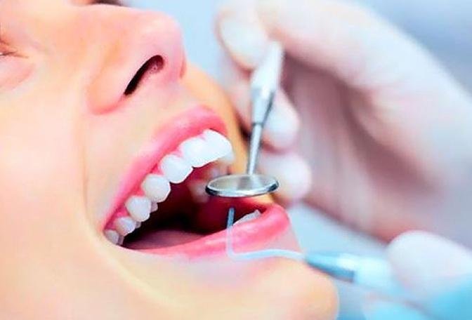 How Long Do Tooth Fillings Last? Dubai Dentists Answer