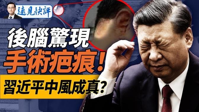 习近平怪异发型泄密：后脑惊现手术疤痕？！可能性最大是这个手术！马英九突称“反共”；中共“接管台湾”预案曝光。｜远见快评 唐靖远 | 2024.08.21