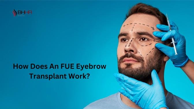 How Does An FUE Eyebrow Transplant Work?