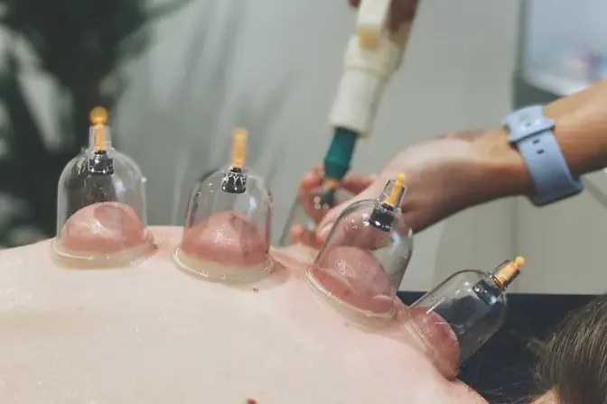 The Art of Fulfillment: Ensuring Satisfaction with Your Hijama Cupping Therapy in Dubai