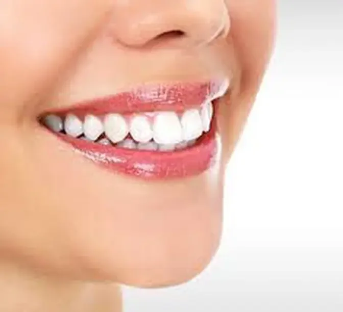 Restore Your Confidence: Gummy Smile Treatment in Dubai