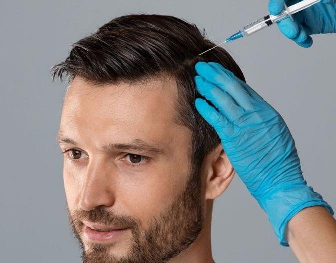 Hair Filler Treatment Safety and Regulations in Dubai