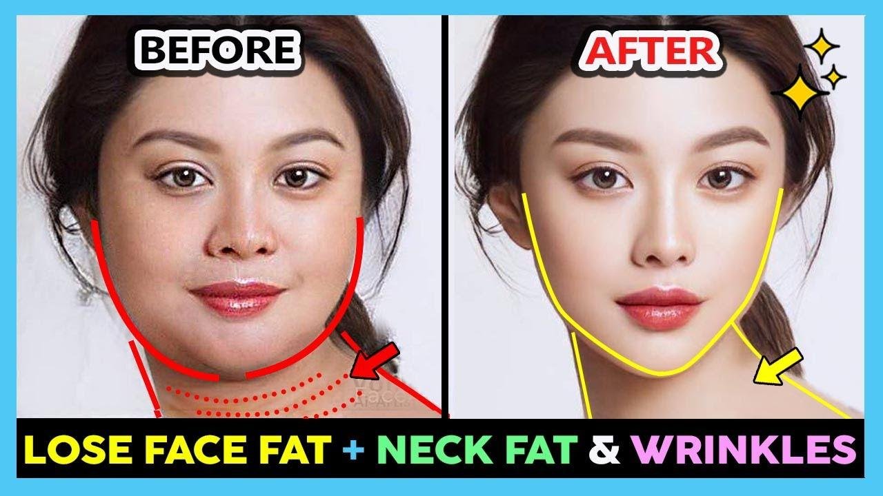 Lose Face Fat & Neck Fat Exercise | Reduce Neck Wrinkles and Double Chin, Get Slim Face Fast