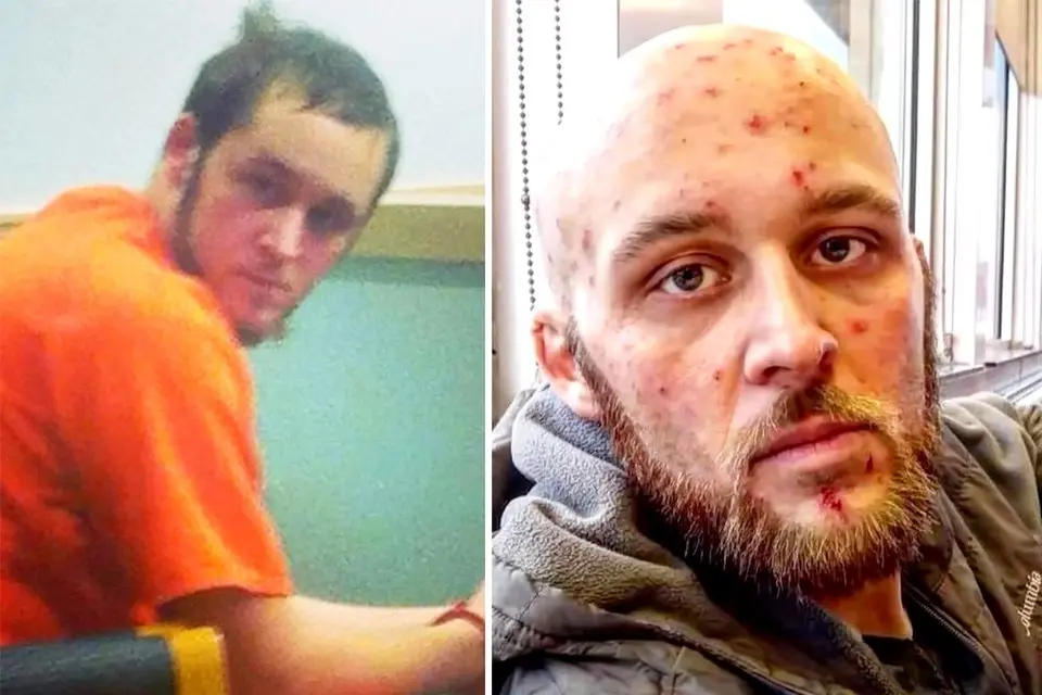 Man Overcomes 11 Years of Addiction Starting at Age 12—See His Incredible Transformation