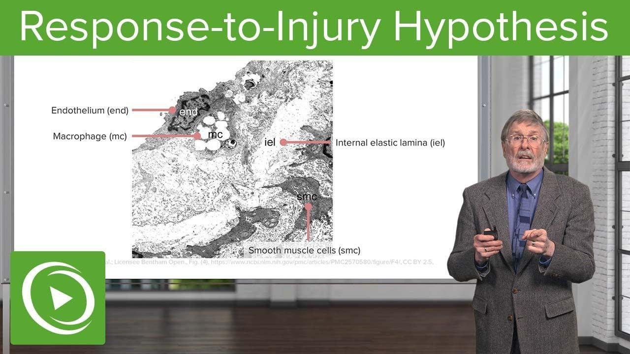 Response-to-Injury Hypothesis | Cellular Pathology