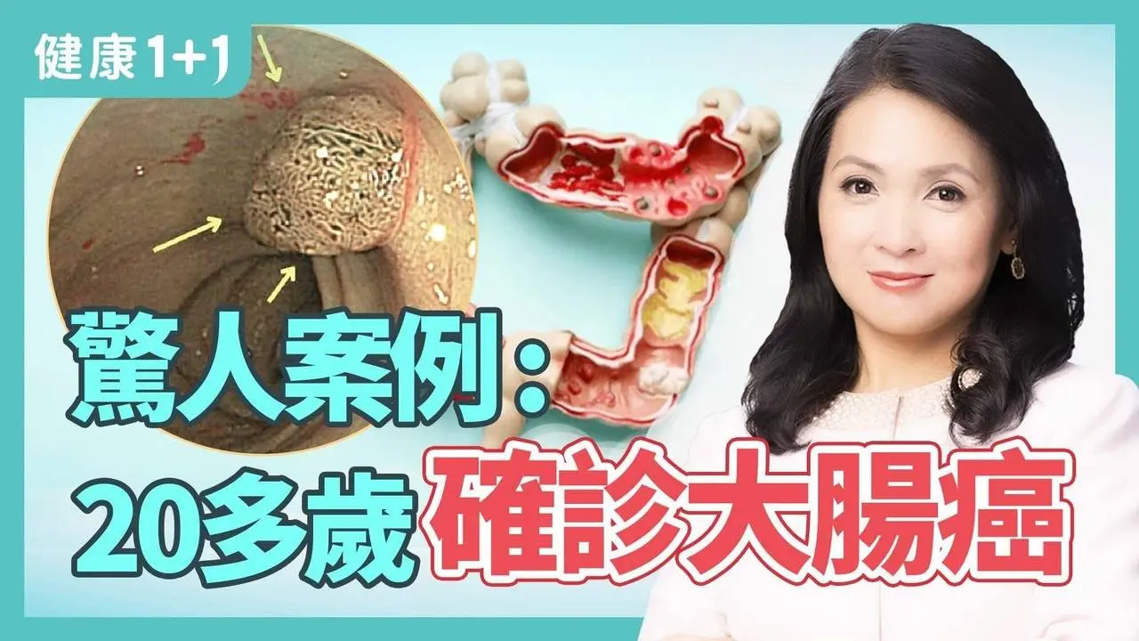 驚人案例：20多歲就確診大腸癌；對抗腸道老化，膳食纖維和益生菌攝取是關鍵 | 健康1+1 · 影片