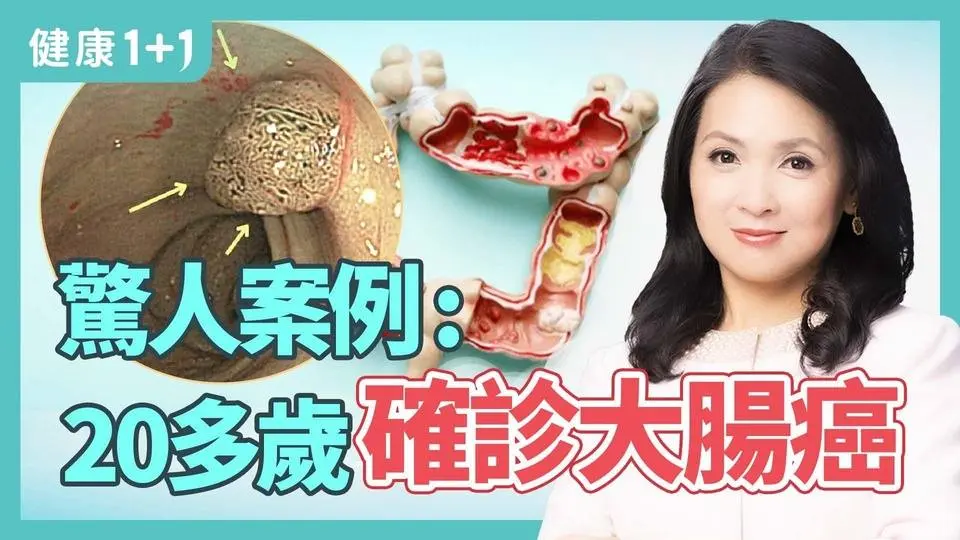 驚人案例：20多歲就確診大腸癌；對抗腸道老化，膳食纖維和益生菌攝取是關鍵 | 健康1+1 · 影片