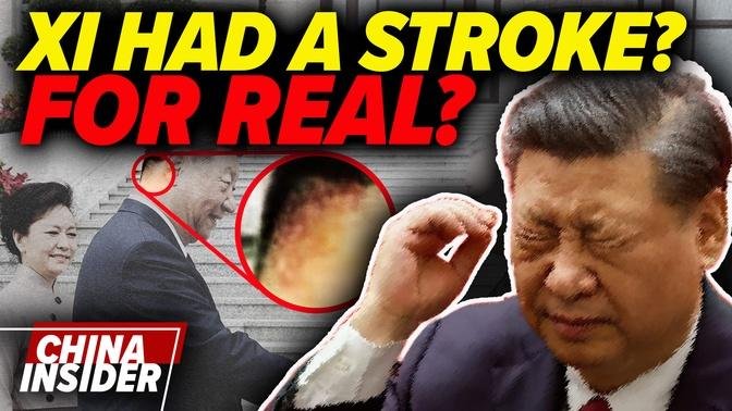 Did Xi have a stroke? for real?