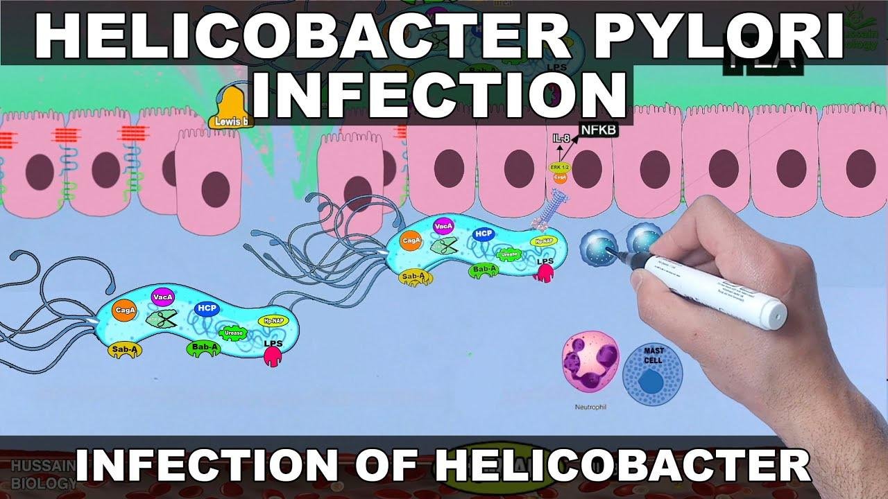 Helicobacter Pylori Pathogenesis | Detailed