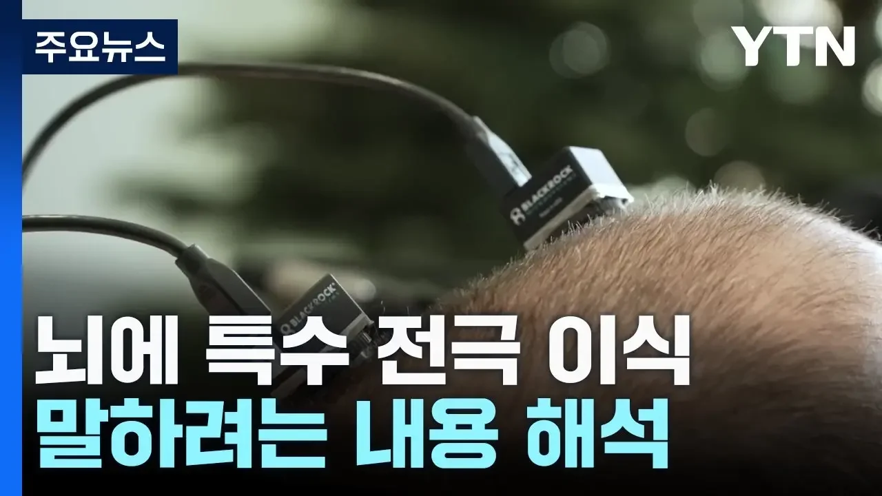 말 못하는 루게릭병 환자 말문 열리다!...주목받는 뇌 전극 기술 / YTN