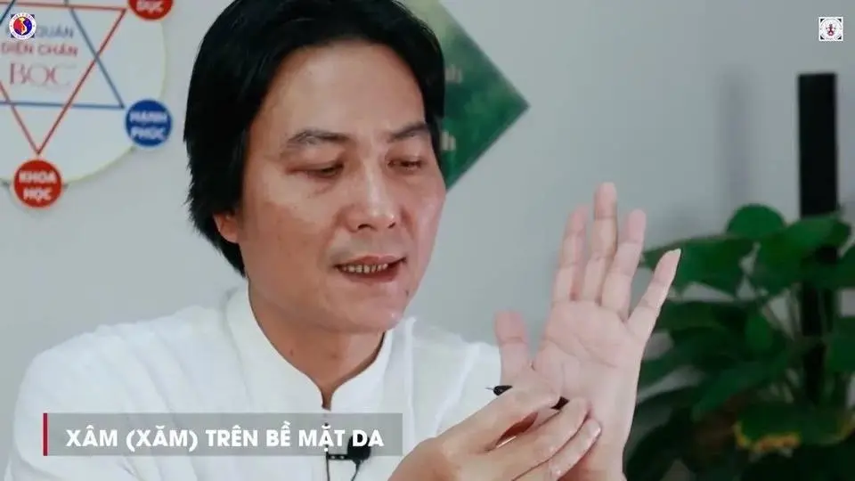 Kỹ Thuật Mãn Thiên Hoa Vũ - Xâm Mứt Gừng Diện Chẩn Bùi Quốc Châu | Thầy Huỳnh Tâm Bình