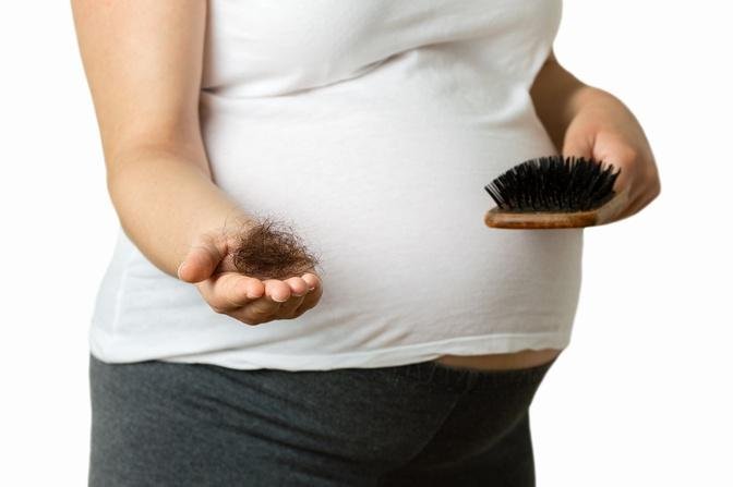 How to prevent hair loss throughout being pregnant