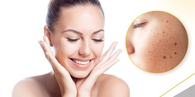 How to Find Affordable Pigmentation Treatment in Dubai