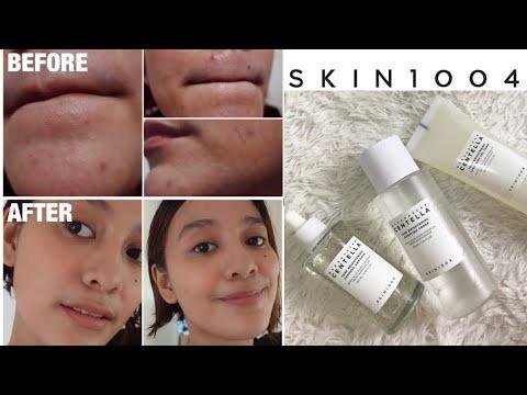 HOW I GOT A CLEARER SKIN (MY SKINCARE ROUTINE) | ft. SKIN1004 Tone Brightening Line