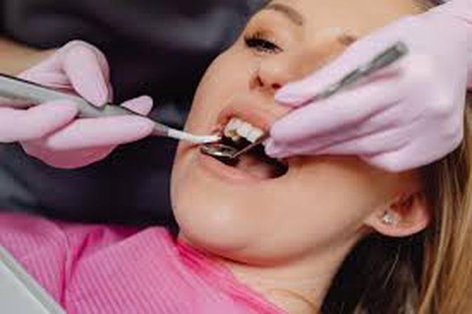 A List Of Some Fantastic Benefits Of Having Excellent Dental Or Oral Hygiene