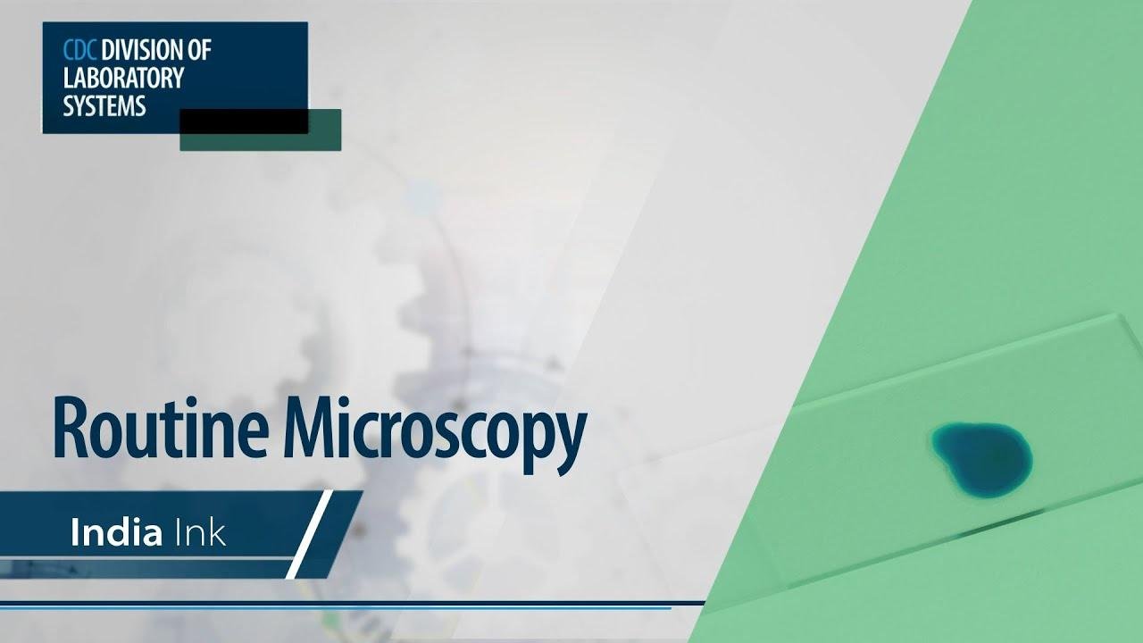 Routine Microscopy – India Ink