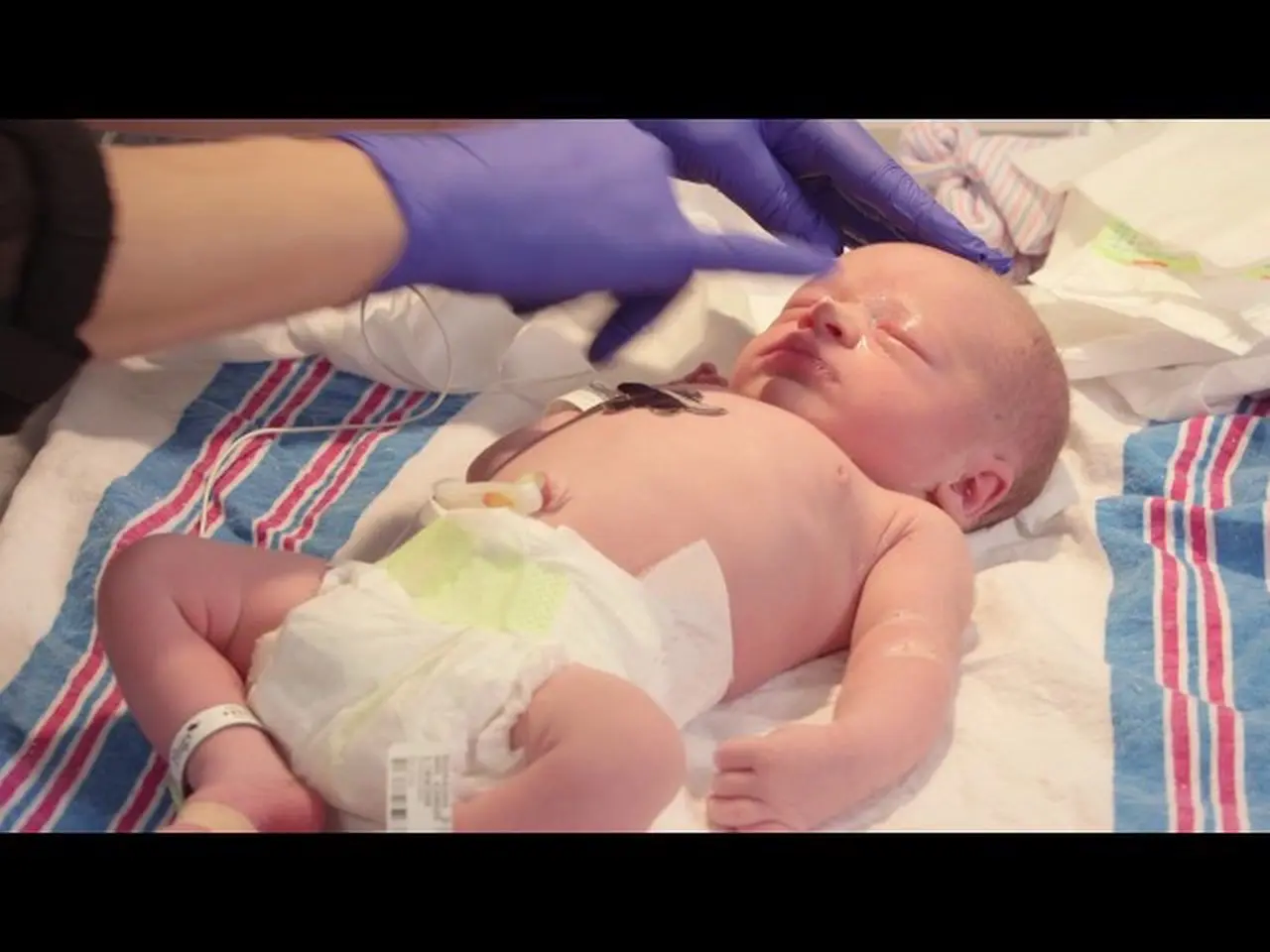 What's going on with my newborn's eyes?