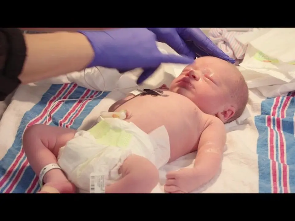 What's going on with my newborn's eyes?