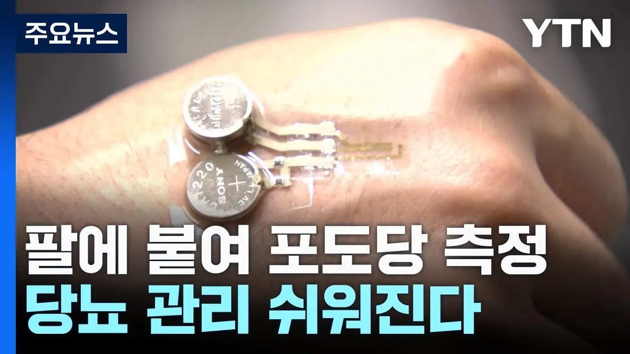 간편하게 팔에 붙여 포도당 측정...당뇨 관리 쉬워진다! / YTN