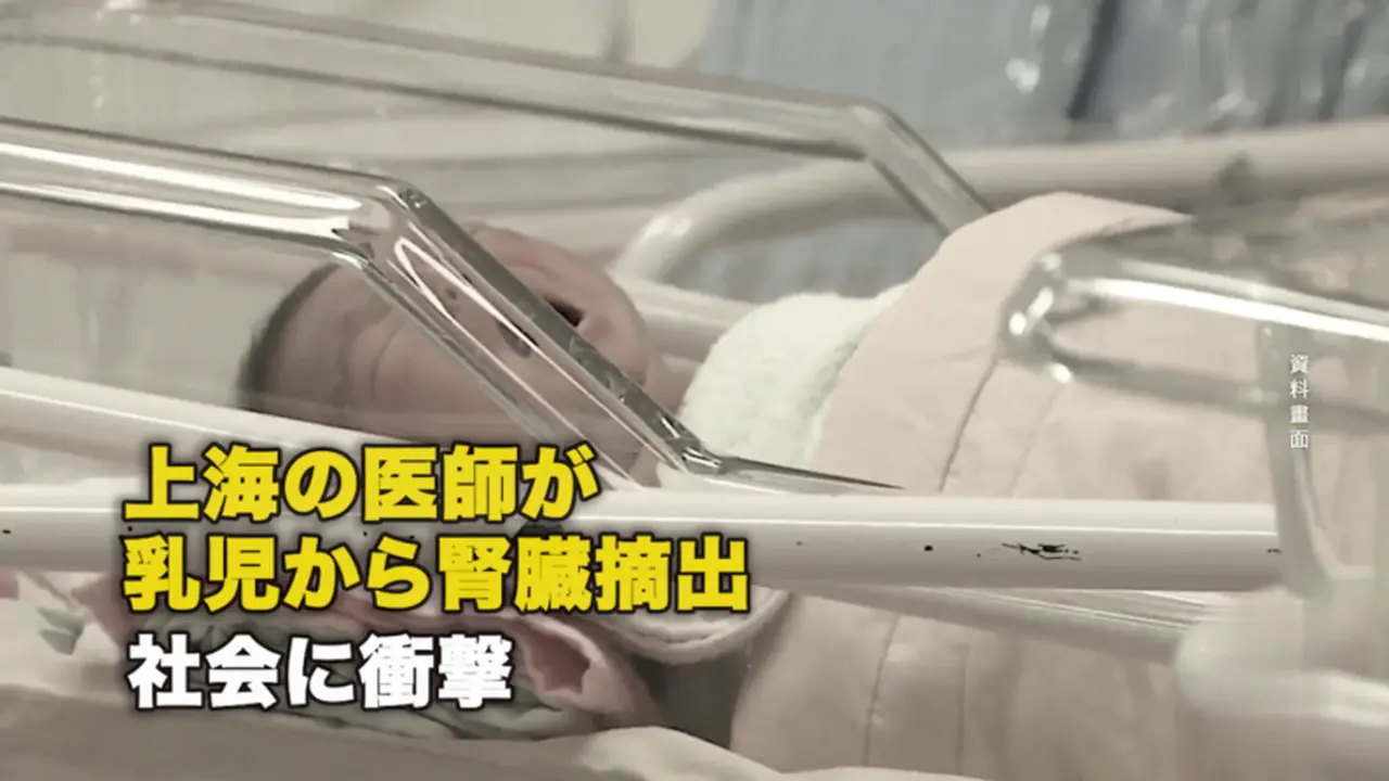 上海の医師が乳児から腎臓摘出 社会に衝撃